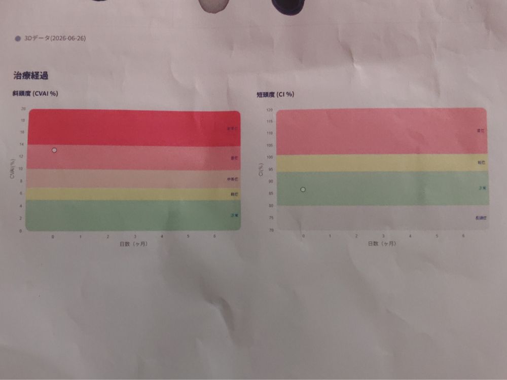 頭の形グラフ部分